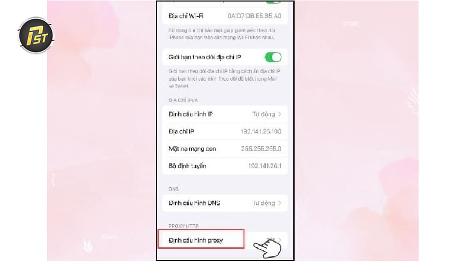 Bước 3: Bắt đầu cấu hình proxy